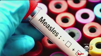 LA County Health Officials Diagnose 2 More Cases Of Measles – CBS Los Angeles