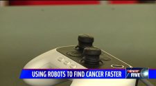 Franciscan Health Cancer Center is 1st in Indiana with robotic technology to treat lung cancer