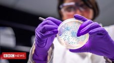 Drug-resistant superbug spreading in Europe's hospitals