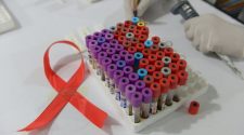 Researchers eliminated HIV from DNA of infected mice in first step towards cure