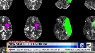 New stroke technology at Our Lady of Lourdes