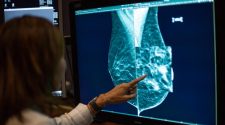 New Breast Cancer Screening Laws, Technology Give Advocates Hope In Closing Gaps In Care
