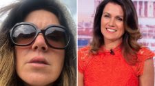 Susanna Reid reveals swollen face after almost breaking her nose by walking into a glass door on holiday