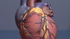 New AI technology for advanced heart attack prediction