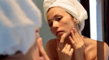 Adult acne: Understanding underlying causes and banishing breakouts - Harvard Health Blog