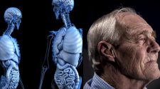 Parkinson's Disease May Start in the Intestines, New Rat Study Conclude