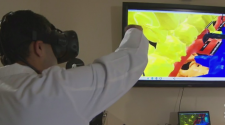 North Texas Doctors Using Video Game Technology Before Complicated Surgeries – CBS Dallas / Fort Worth