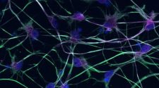 Stem cell technology offers new insight into motor neuron disease