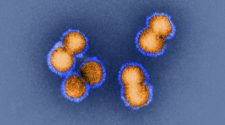 Risky Viruses: Health Officials Debate How Much To Reveal About Research : Shots
