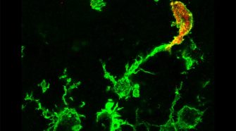 New Technique Illuminates Migrating Macrophages To Help Study Stroke