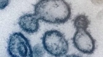 Scientists at Oxford University have developed a rapid testing technology for coronavirus