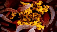 Alameda County Issues Public Health Emergency, Santa Clara County Announces 3 New Cases of Coronavirus – NBC Bay Area