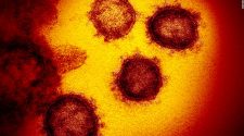 A seemingly healthy woman's sudden death is now the first known US coronavirus-related fatality, LA Times reports