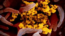 Coronavirus Live Updates: Worldwide Toll of Confirmed Virus Deaths Nears 100,000