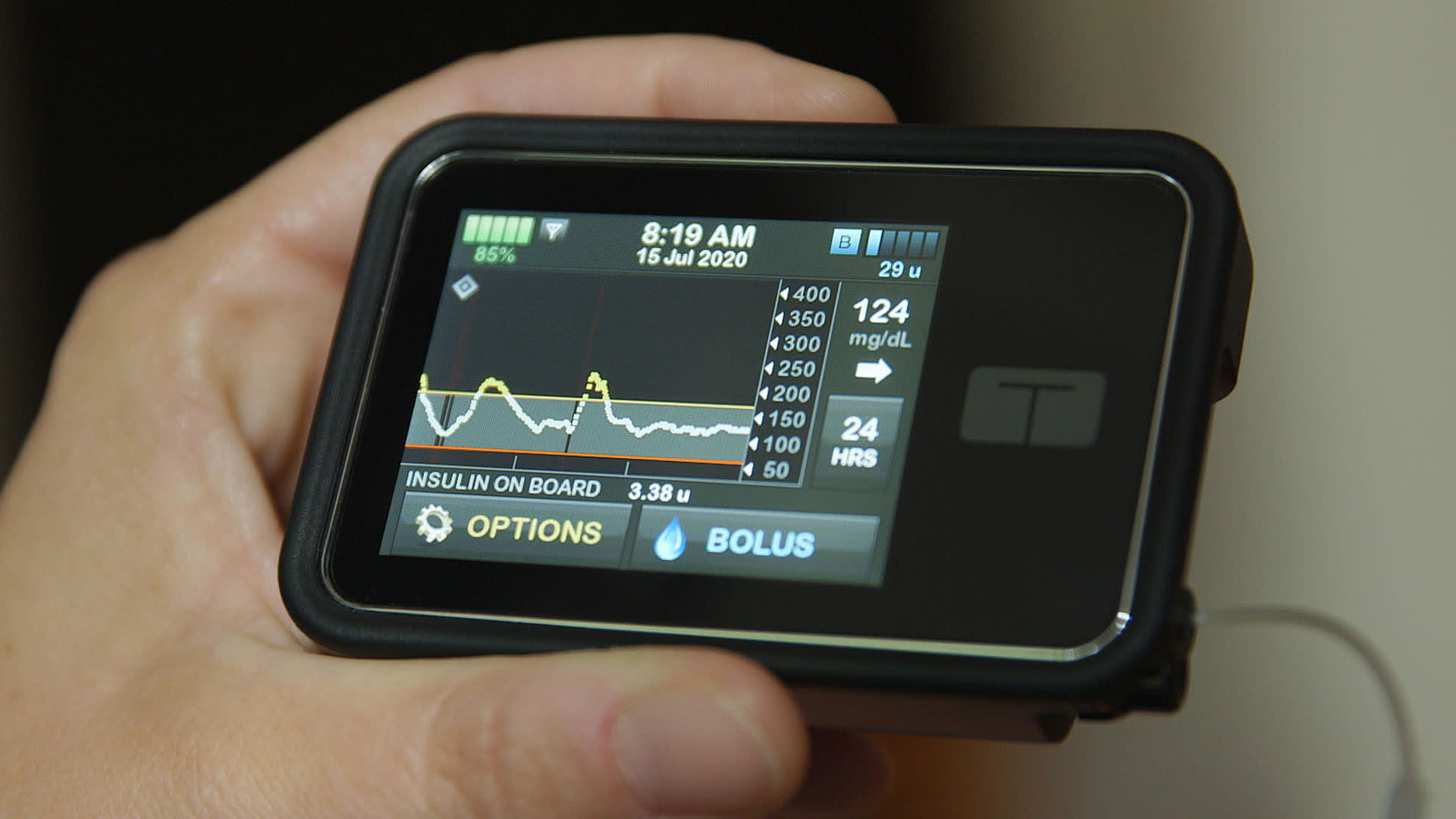 How insulin pump technology is getting smarter
