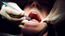 Wisconsin dentist accused of breaking patients’ teeth in insurance fraud scheme