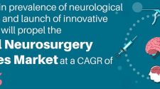 Neurosurgery Devices Market 2020 – Industry Size, Share, Technology Trends, Business Growth Opportunities, In-depth Analysis, Region Statics, Top Company Profile, Forecast to 2025
