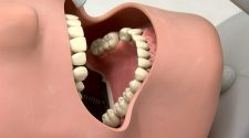 Research suggests poor oral health could lead to worse COVID-19 outcomes