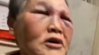 Elderly Asian woman attacked in San Francisco fights back, sends alleged attacker to hospital