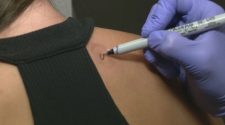 New technology allows doctors to test for skin cancer via stickers that collect skin cells
