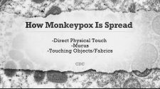 How do you catch Monkeypox? FOX5 gets answers from health district pharmacist