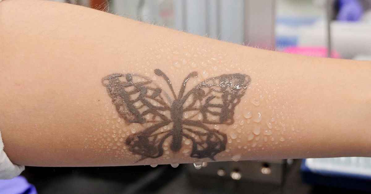 S.Korea develops nanotech tattoo as health monitoring device